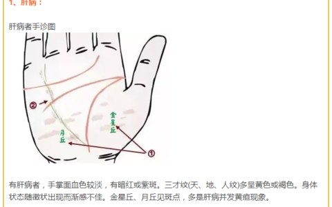 掌纹诊病实用图谱(掌纹诊病实用大全)