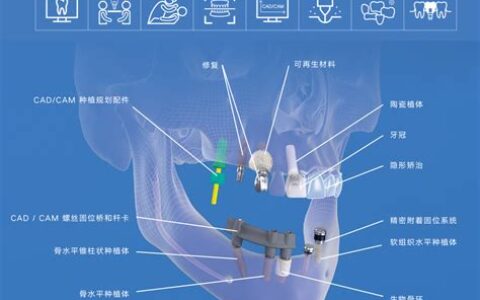 口腔种植体系统集中带有哪些(口腔种植体系统有哪些?)