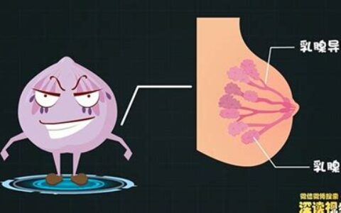 乳房小叶增生是啥症状(乳房小叶增生如何治疗)